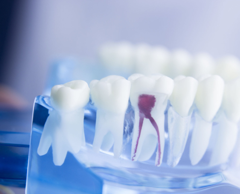 Endodontie | Zahnarzt Gunnar Gansen Schönwalde