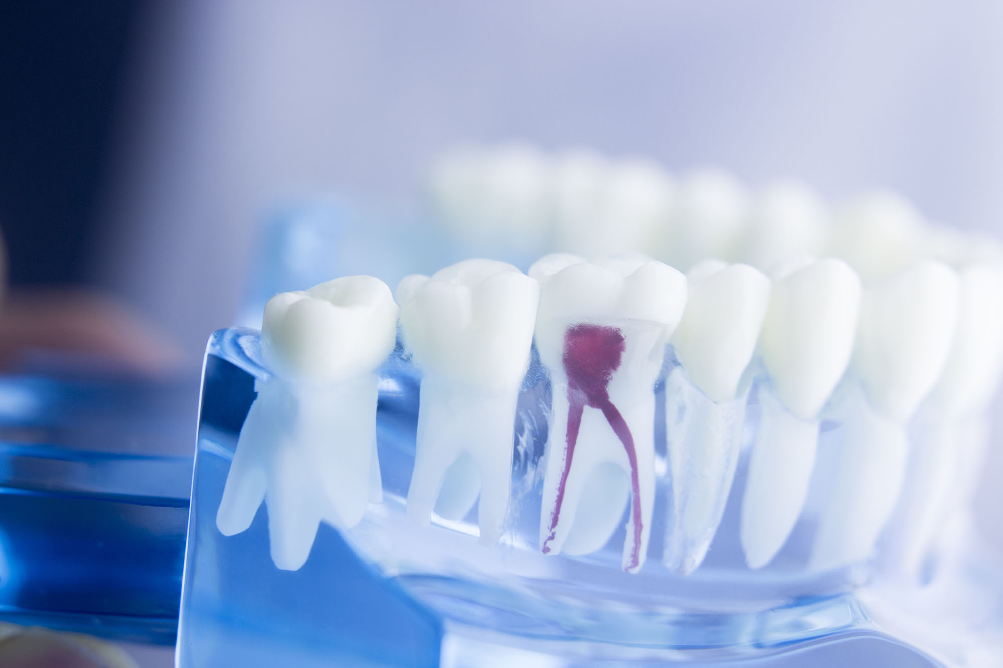 Endodontie | Zahnarzt Gunnar Gansen Schönwalde